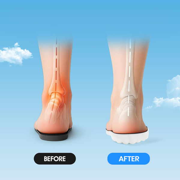 CloudSolex 4D Support Insoles